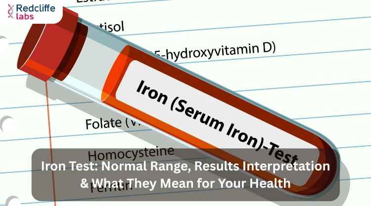 Iron Test: Normal Range, Results Interpretation & What They Mean for Your Health