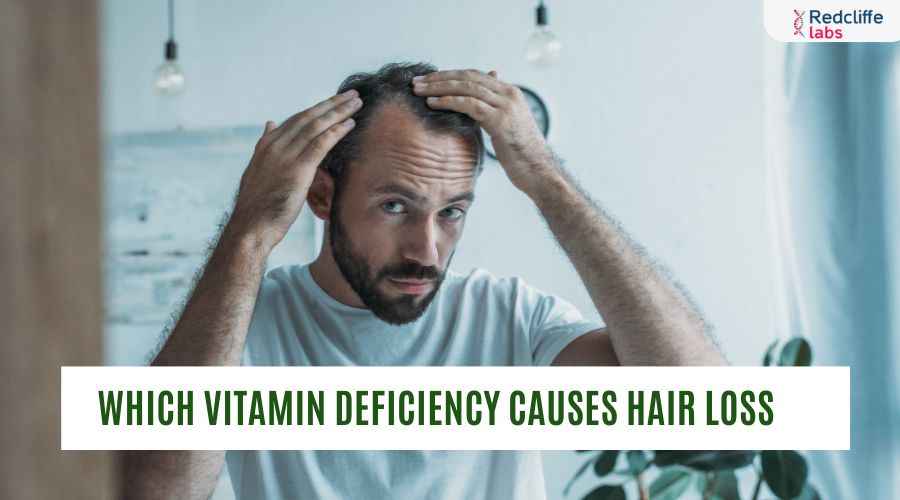 Which Vitamin Deficiency Causes Hair Loss?