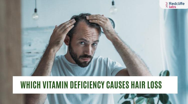 Which Vitamin Deficiency Causes Hair Loss?