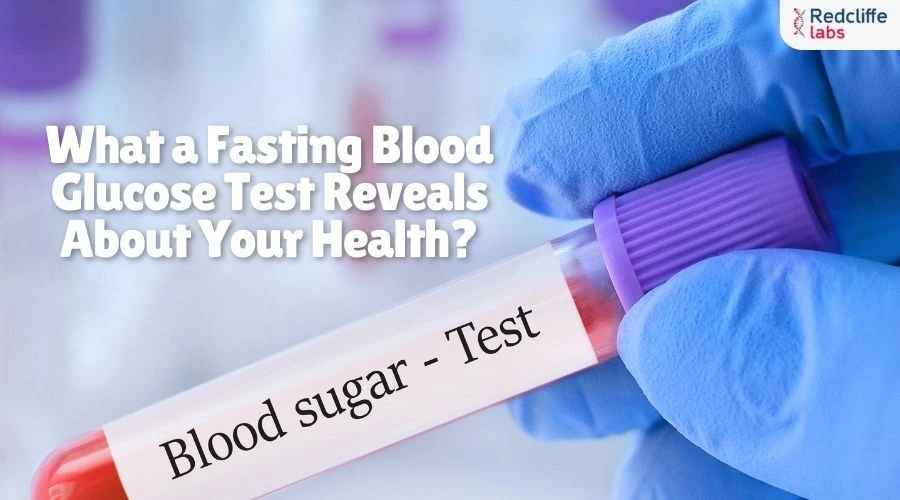 What a Fasting Blood Glucose Test Reveals About Your Health?