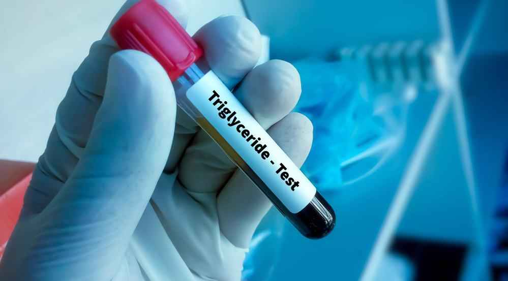 High Triglycerides: Everything You Need To Know
