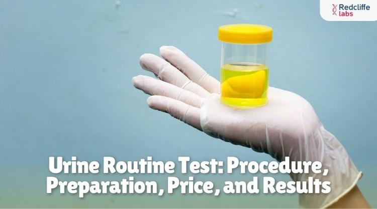 Urine Routine Test: Procedure, Preparation, Price, and Results