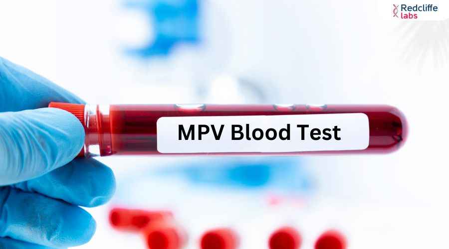 MPV Blood Test in Hindi: प्लेटलेट वॉल्यूम की जानकारी