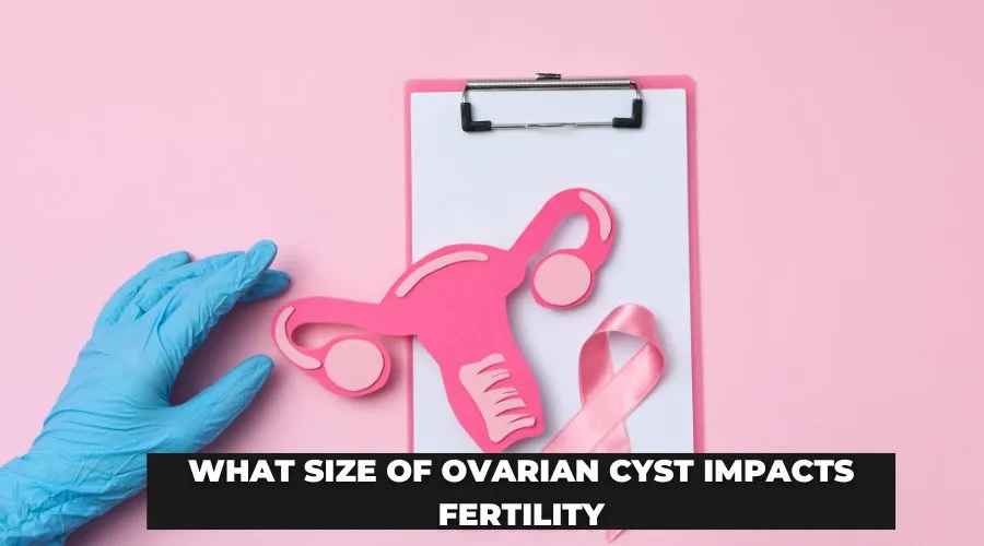 What Size of Ovarian Cyst Impacts Fertility?