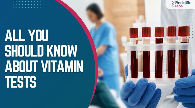 Vitamins Tests: Types, Names & Benefits