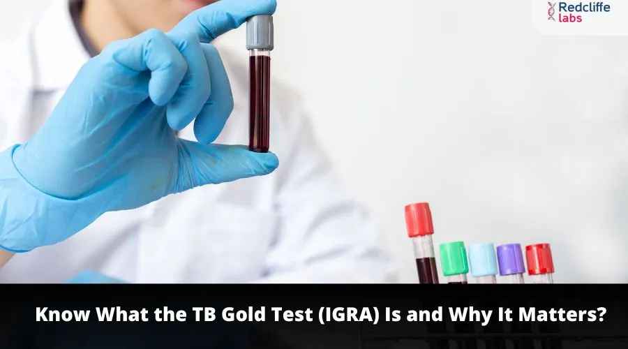 Know What the TB Gold Test (IGRA) Is and Why It Matters?