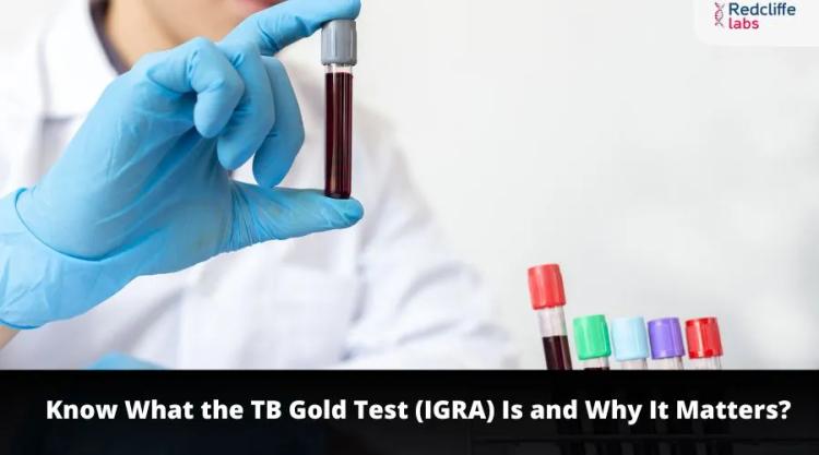 Know What the TB Gold Test (IGRA) Is and Why It Matters?