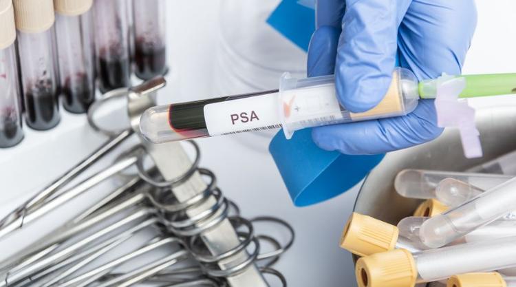 10 Best Ways to Lower Your PSA Levels Naturally