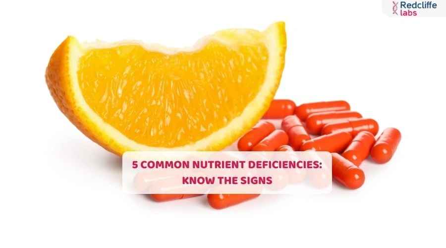5 Common Nutrient Deficiencies: Know the Signs