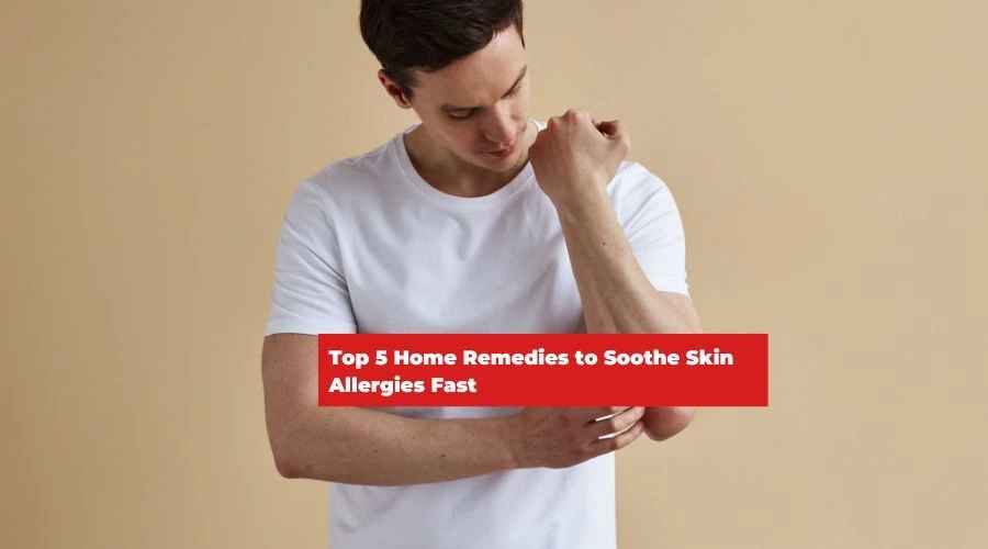 Top 5 Home Remedies to Soothe Skin Allergies Fast