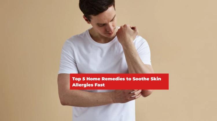 Top 5 Home Remedies to Soothe Skin Allergies Fast