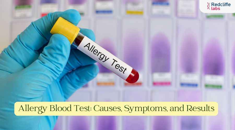 Allergy Blood Test: Causes, Symptoms, and Results