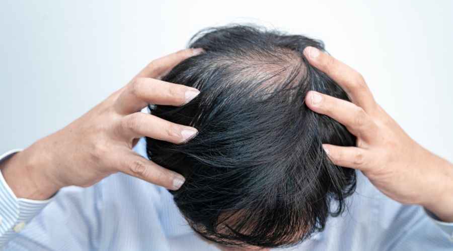 How To Increase Hair Density?
