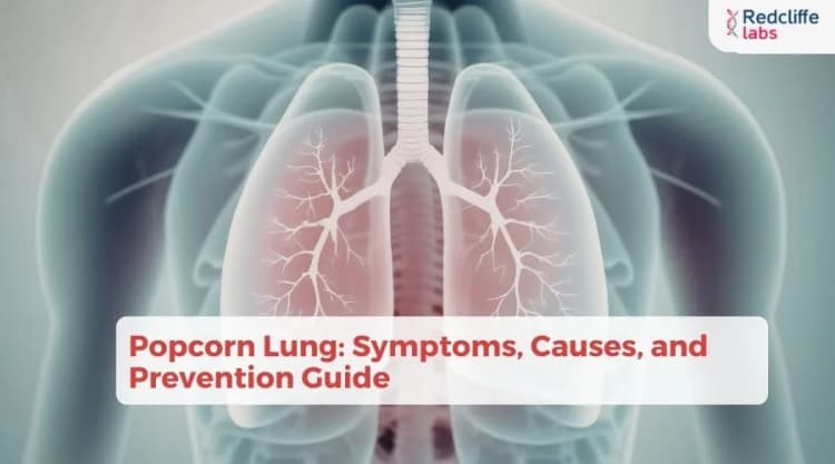 Popcorn Lung: Symptoms, Causes, and Prevention Guide
