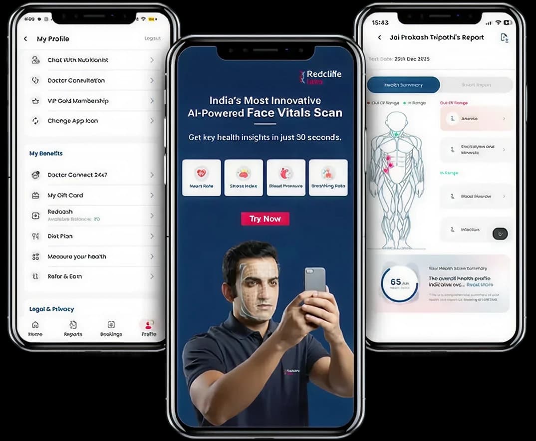 download_smart_report_banner